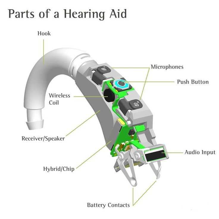 diagram hearing aid parts